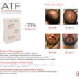 rutina-jaircare-antialopecia-2