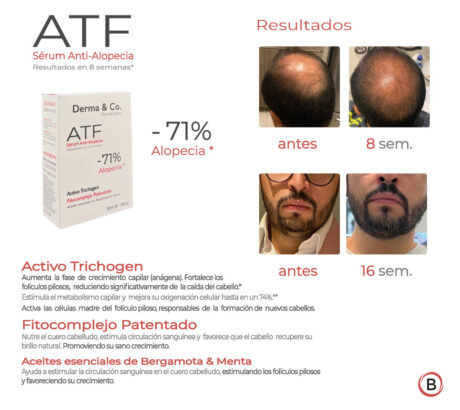 rutina-jaircare-antialopecia-2