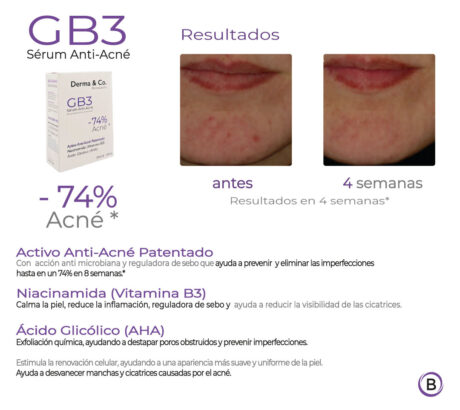 rutina-skincare-antiacne2