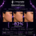 serum-blemishless2